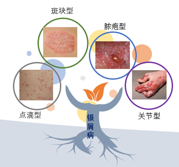 干细胞存储