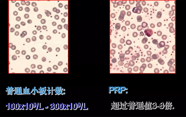 免疫细胞存储